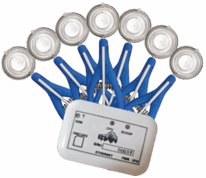 ERWIN™ SmartScoop rendszer